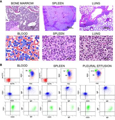 The Traf2DNxBCL2-tg Mouse Model of Chronic Lymphocytic Leukemia/Small Lymphocytic Lymphoma Recapitulates the Biased IGHV Gene Usage, Stereotypy, and Antigen-Specific HCDR3 Selection of Its Human Counterpart